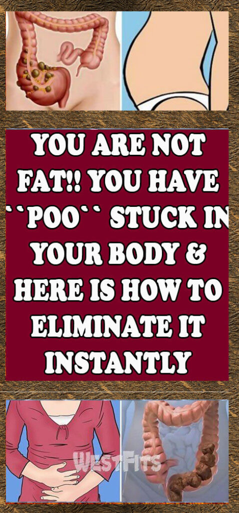 YOU ARE NOT FAT!! YOU HAVE “POO” STUCK IN YOUR BODY & HERE IS HOW TO ELIMINATE IT INSTANTLY