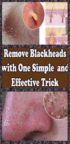 GRANDMA TOLD ME THIS TRICK. IT HEALED MY CRACKED HEELS IN JUST 1 NIGHT!!!